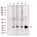 Western blot analysis of extracts from Mouse thymus tissue, using ARL15 Antibody. The lane on the left was treated with blocking peptide.