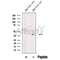 Western blot analysis of extracts from Human breast cancer tissue, using ARPC1B Antibody. The lane on the left was treated with blocking peptide.
