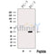 Western blot analysis of extracts from PC-3 cells, using ARPC2 Antibody. The lane on the left was treated with blocking peptide.
