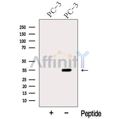 Western blot analysis of extracts from PC-3 cells, using ARPC2 Antibody. The lane on the left was treated with blocking peptide.