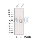 Western blot analysis of extracts from HepG2 cells, using ATOH1 Antibody. The lane on the left was treated with blocking peptide.