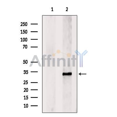 Western blot analysis of extracts from HEK-293 cells, using ATP6V1E1 Antibody. The lane on the left was treated with blocking peptide.