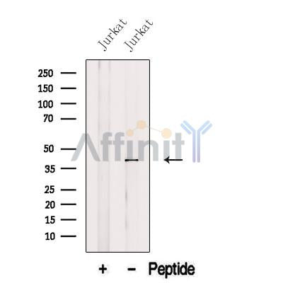 Western blot analysis of extracts from Jurkat cells, using AUP1 Antibody. The lane on the left was treated with blocking peptide.