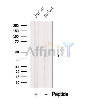 Western blot analysis of extracts from Jurkat cells, using AUP1 Antibody. The lane on the left was treated with blocking peptide.