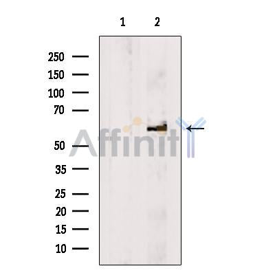 Western blot analysis of extracts from Mouse testis tissue, using BBS9 Antibody. The lane on the left was treated with blocking peptide.