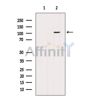 Western blot analysis of extracts from HepG2 cells, using BBX Antibody. The lane on the left was treated with blocking peptide.
