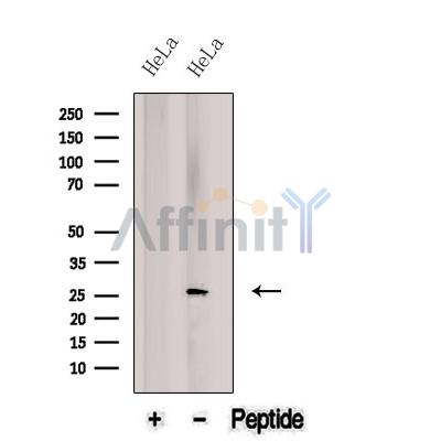 Western blot analysis of extracts from HeLa cells, using BNIP1 Antibody. The lane on the left was treated with blocking peptide.