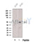 Western blot analysis of extracts from A549 cells, using BPIL1 Antibody. The lane on the left was treated with blocking peptide.