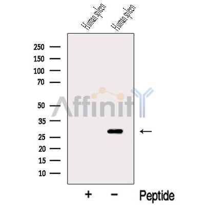 Western blot analysis of extracts from Human spleen tissue, using C18orf55 Antibody. The lane on the left was treated with blocking peptide.
