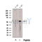 Western blot analysis of extracts from K-562 cells, using CDR2L Antibody. The lane on the left was treated with blocking peptide.