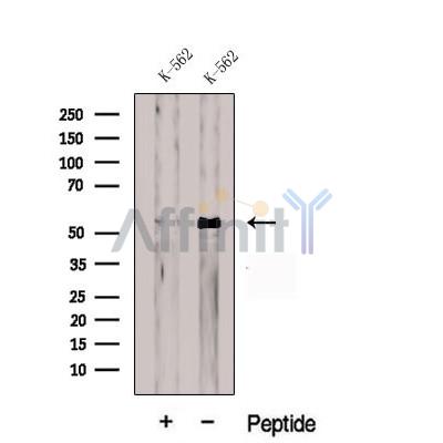Western blot analysis of extracts from K-562 cells, using CDR2L Antibody. The lane on the left was treated with blocking peptide.