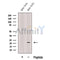 Western blot analysis of extracts from Mouse brain tissue, using CPLX3 Antibody. The lane on the left was treated with blocking peptide.