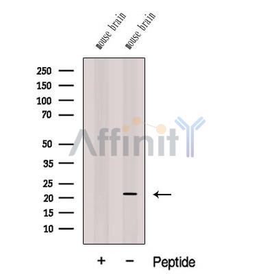 Western blot analysis of extracts from Mouse brain tissue, using CPLX3 Antibody. The lane on the left was treated with blocking peptide.