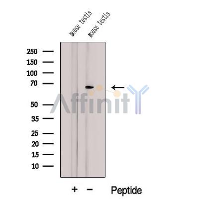 Western blot analysis of extracts from Mouse testis tissue, using CTPS2 Antibody. The lane on the left was treated with blocking peptide.