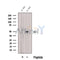 Western blot analysis of extracts from Mouse  lung, using CUGBP2 Antibody. The lane on the left was treated with blocking peptide.