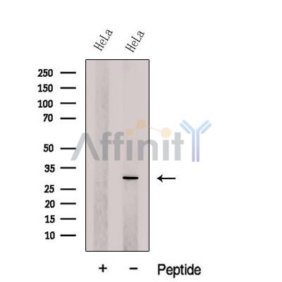 Western blot analysis of extracts from HeLa cells, using DCUN1D5 Antibody. The lane on the left was treated with blocking peptide.