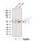 Western blot analysis of extracts from various samples, using DMKN Antibody.
 Lane 1: Mouse  lung treated with blocking peptide;
 Lane 2: Mouse  lung;
 Lane 3: Hybridoma cells;
 Lane 4: Mouse  brain;
 Lane 5: Mouse  liver.