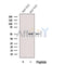 Western blot analysis of extracts from Mouse brain tissue, using FADS1 Antibody. The lane on the left was treated with blocking peptide.