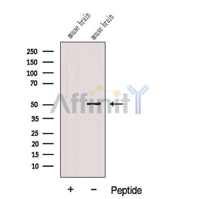Western blot analysis of extracts from Mouse brain tissue, using FADS1 Antibody. The lane on the left was treated with blocking peptide.