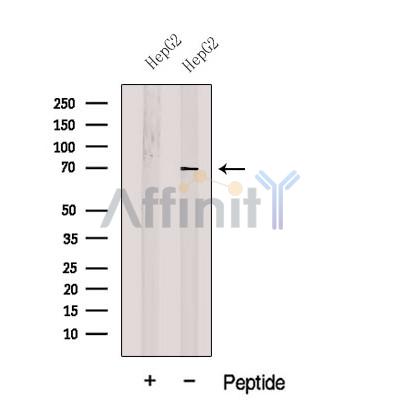 Western blot analysis of extracts from HepG2 cells, using FATP4 Antibody. The lane on the left was treated with blocking peptide.