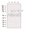 Western blot analysis of extracts from HeLa cells, using FLCN Antibody. The lane on the left was treated with blocking peptide.