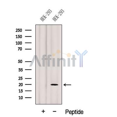 Western blot analysis of extracts from HEK-293 cells, using GEMIN6 Antibody. The lane on the left was treated with blocking peptide.