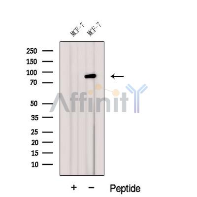 Western blot analysis of extracts from MCF-7 cells, using GGCX Antibody. The lane on the left was treated with blocking peptide.