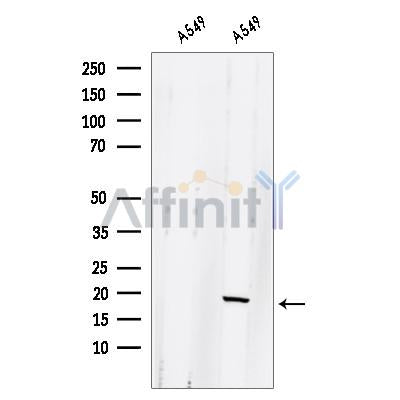 Western blot analysis of extracts from A549 cells, using GLRX2 Antibody. The lane on the left was treated with blocking peptide.