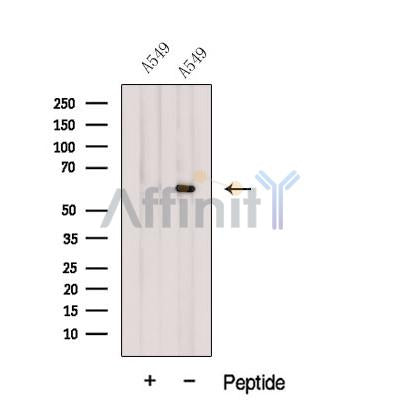 Western blot analysis of extracts from A549 cells, using Glypican4 Antibody. The lane on the left was treated with blocking peptide.