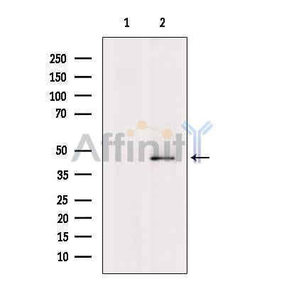 Western blot analysis of extracts from Jurkat cells?, using GNAQ Antibody. The lane on the left was treated with blocking peptide.