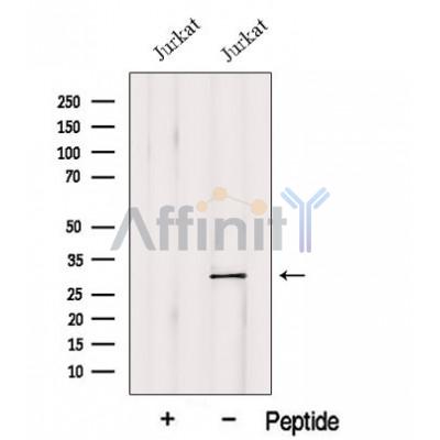 Western blot analysis of extracts from Jurkat cells, using GSTO1 Antibody. The lane on the left was treated with blocking peptide.