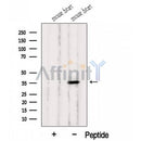 Western blot analysis of extracts from Mouse heart tissue, using HIBADH Antibody. The lane on the left was treated with blocking peptide.