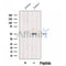 Western blot analysis of extracts from Jurkat cells, using HMG20A Antibody. The lane on the left was treated with blocking peptide.