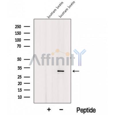 Western blot analysis of extracts from C6, using ICMT Antibody. The lane on the left was treated with blocking peptide.