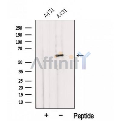 Western blot analysis of extracts from A431 cells, using IMPDH1 Antibody. The lane on the left was treated with blocking peptide.