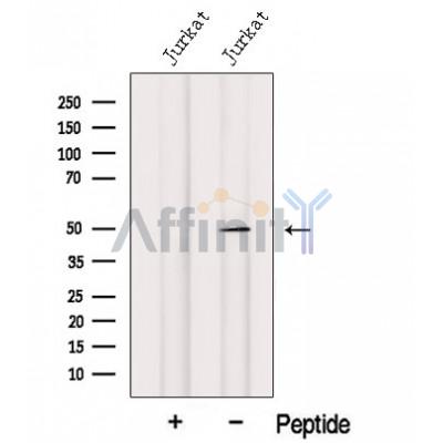 Western blot analysis of extracts from Hela, using IRF1 Antibody. The lane on the left was treated with blocking peptide.