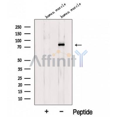 Western blot analysis of extracts from Human muscle tissue, using LDB3 Antibody. The lane on the left was treated with blocking peptide.