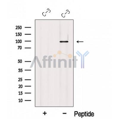 Western blot analysis of extracts from C-3 cells, using MCC Antibody. The lane on the left was treated with blocking peptide.