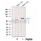 Western blot analysis of extracts from Human liver tissue, using MCCC2 Antibody. The lane on the left was treated with blocking peptide.