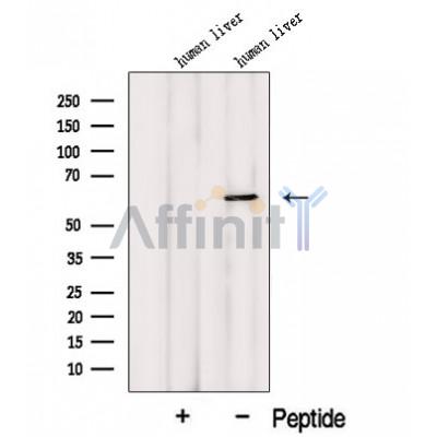 Western blot analysis of extracts from Human liver tissue, using MCCC2 Antibody. The lane on the left was treated with blocking peptide.