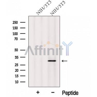 Western blot analysis of extracts from NIH/3T3 cells, using MITD1 Antibody. The lane on the left was treated with blocking peptide.