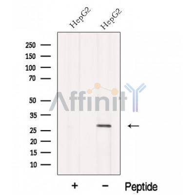 Western blot analysis of extracts from Myeloma cells, using MMAB Antibody. The lane on the left was treated with blocking peptide.