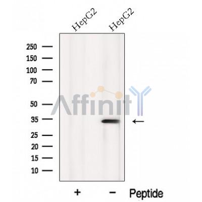 Western blot analysis of extracts from various samples, using MTCH2 Antibody.
 Lane 1: HepG2, treated with blocking peptide;
 Lane 2: HepG2;
 Lane 3: Rat  kidney;
 Lane 4: Rat  brain.
