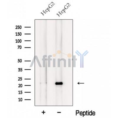 Western blot analysis of extracts from HepG2 cells, using NCS1 Antibody. The lane on the left was treated with blocking peptide.