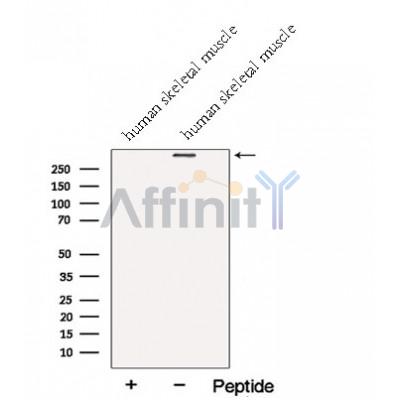 Western blot analysis of extracts from Human skeletal muscle  tissue, using NEB-Specific Antibody. The lane on the left was treated with blocking peptide.