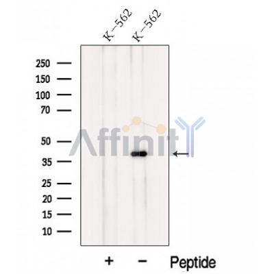 Western blot analysis of extracts from K-562 cells, using NF45 Antibody. The lane on the left was treated with blocking peptide.