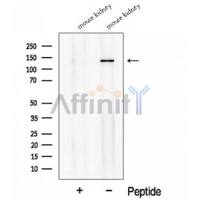 Western blot analysis of extracts from Mouse kidney tissue, using NKCC2 Antibody. The lane on the left was treated with blocking peptide.