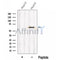 Western blot analysis of extracts from Myeloma cells, using NMD3 Antibody. The lane on the left was treated with blocking peptide.