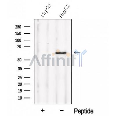Western blot analysis of extracts from Myeloma cells, using NMD3 Antibody. The lane on the left was treated with blocking peptide.