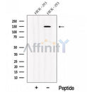 Western blot analysis of extracts from HEK-293 cells, using NPHP3 Antibody. The lane on the left was treated with blocking peptide.